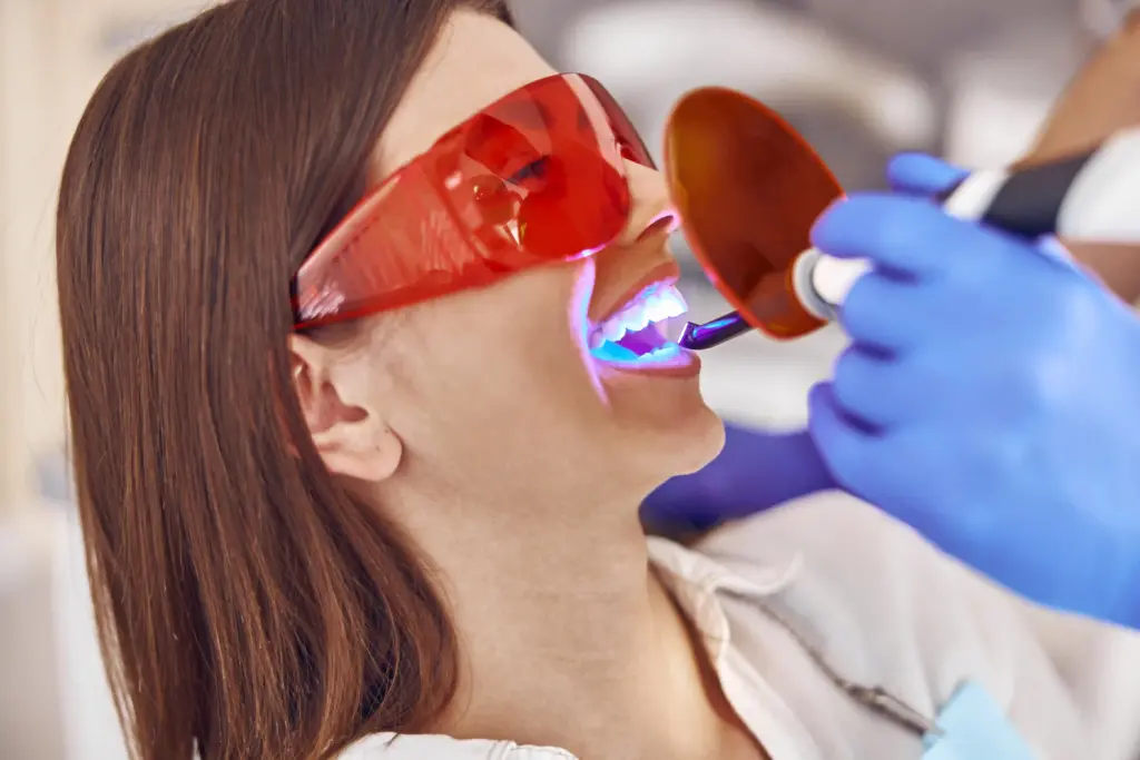 Dentista realizando un blanqueamiento profesional