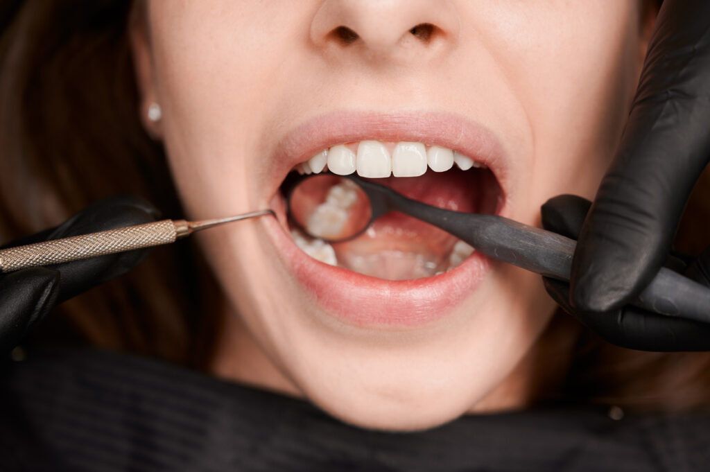 Primer plano de una revisión dental